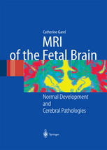 MRI of the Fetal Brain : Normal Development and Cerebral Pathologies