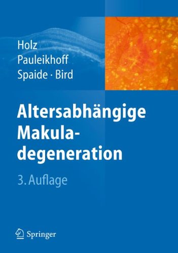 Altersabhangige Makuladegeneration