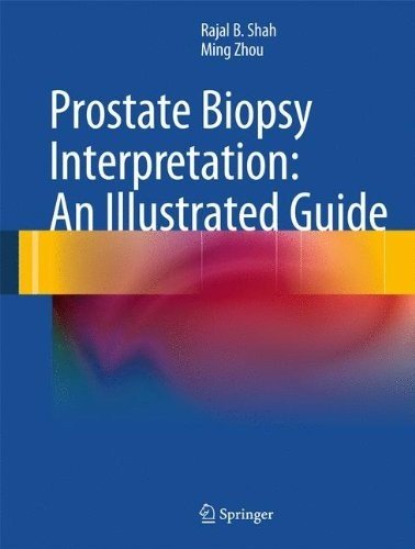 Prostate Biopsy Interpretation