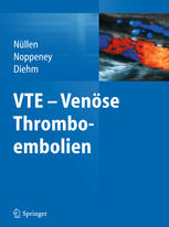 VTE - Venöse Thromboembolien