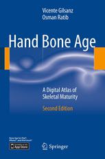 Hand Bone Age