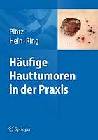 Häufige Hauttumoren in der Praxis