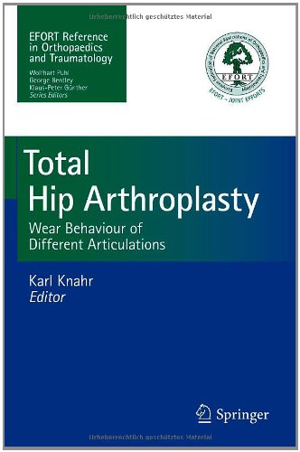 Total Hip Arthroplasty