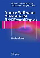 Cutaneous Manifestations of Child Abuse and Their Differential Diagnosis