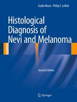 Histological Diagnosis of Nevi and Melanoma