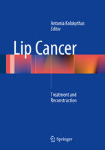 Lip Cancer Treatment and Reconstruction