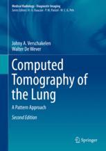 Computed Tomography of the Lung : a Pattern Approach