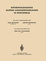 Differentialdiagnose Seltener Lungenerkrankungen im Röntgenbild