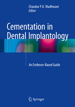 Cementation in dental implantology : an evidence-based guide