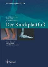 FussdeformitÄten : Der Knickplattfuss