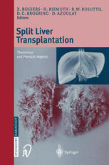 Split liver transplantation : theoretical and practical aspects