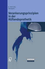 Verankerungsprinzipien in der Hüftendoprothetik