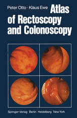 Atlas of Rectoscopy and Coloscopy.