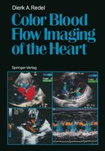 Color blood flow imaging of the heart