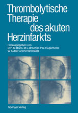 Thrombolytische Therapie des akuten Herzinfarkts