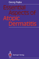 Essential aspects of atopic dermatitis