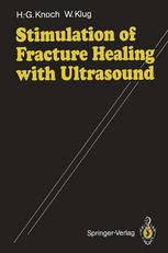 Stimulation of Fracture Healing with Ultrasound