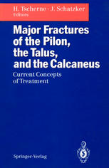 Major Fractures of the Pilon, the Talus, and the Calcaneus : Current Concepts of Treatment