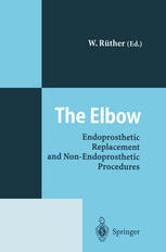 The Elbow : Endoprosthetic Replacement and Non-Endoprosthetic Procedures