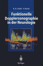 Funktionelle Dopplersonographie in der Neurologie