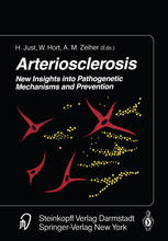 Arteriosclerosis : New Insights into Pathogenetic Mechanisms and Prevention