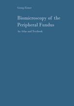 Biomicroscopy of the Peripheral Fundus : an Atlas and Textbook