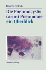 Die Pneumocystis carinii Pneumonie-- ein Überblick