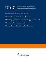 Illustrated tumor nomenclature.