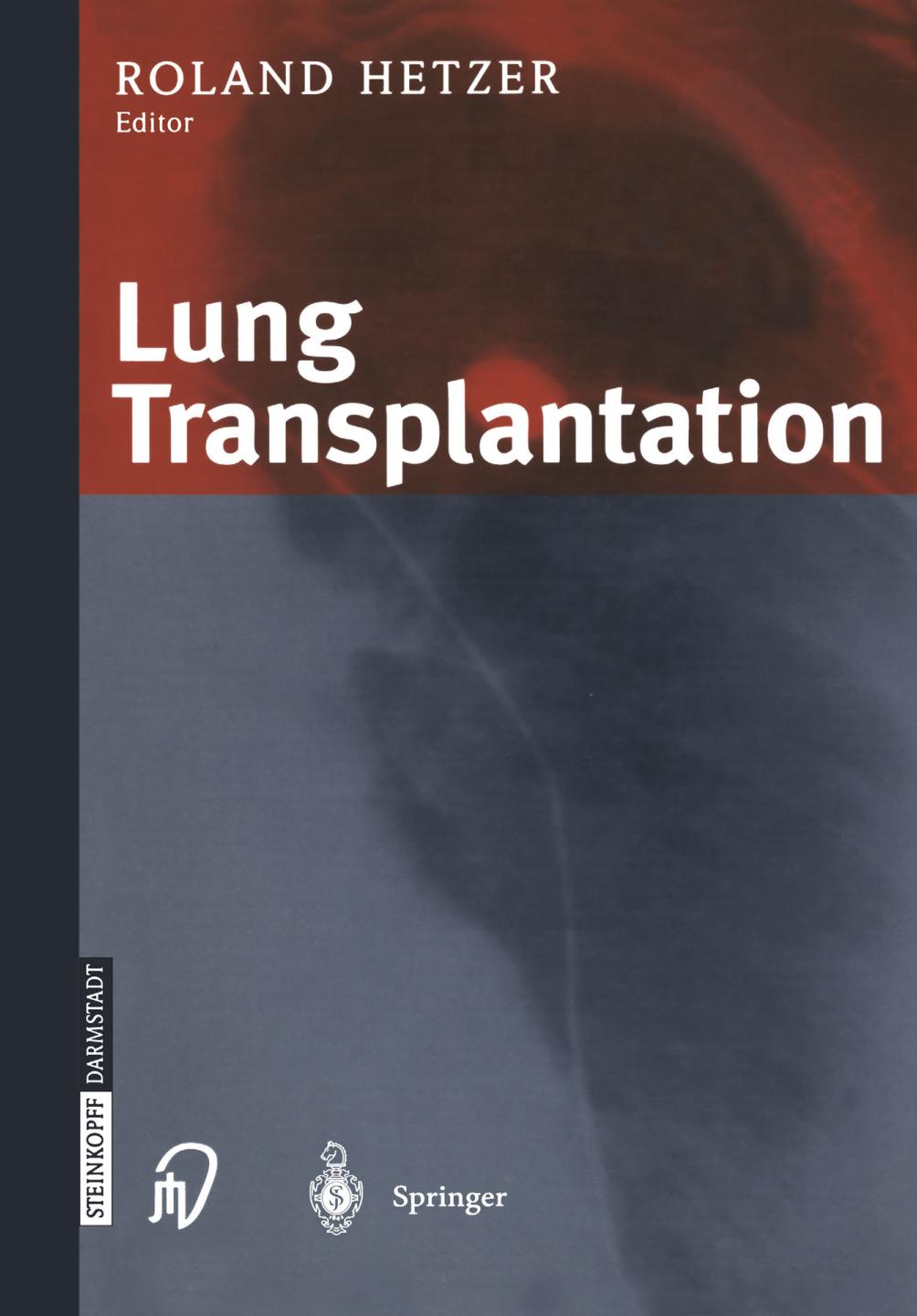 Lung transplantation