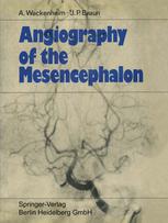 Angiography of the mesencephalon