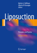 Liposuction : principles and practice