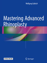 Mastering Advanced Rhinoplasty