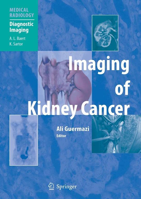 Imaging of Kidney Cancer (Medical Radiology)