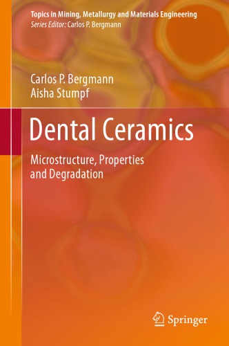 Dental Ceramics