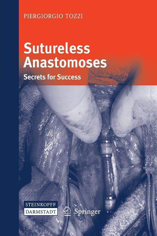 Sutureless Anastomoses: Secrets for Success