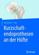 Kurzschaftendoprothesen an der Hüfte.