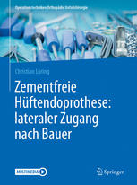 Zementfreie Hüftendoprothese : lateraler Zugang nach Bauer