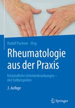 Rheumatologie aus der Praxis Entzündliche Gelenkerkrankungen - mit Fallbeispielen