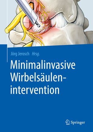 Minimalinvasive Wirbelsäulenintervention