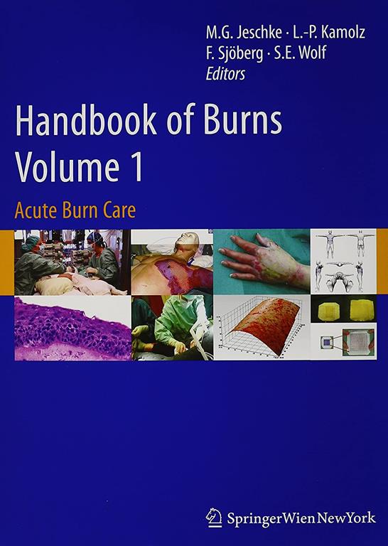 Handbook of Burns: Volume 1+2