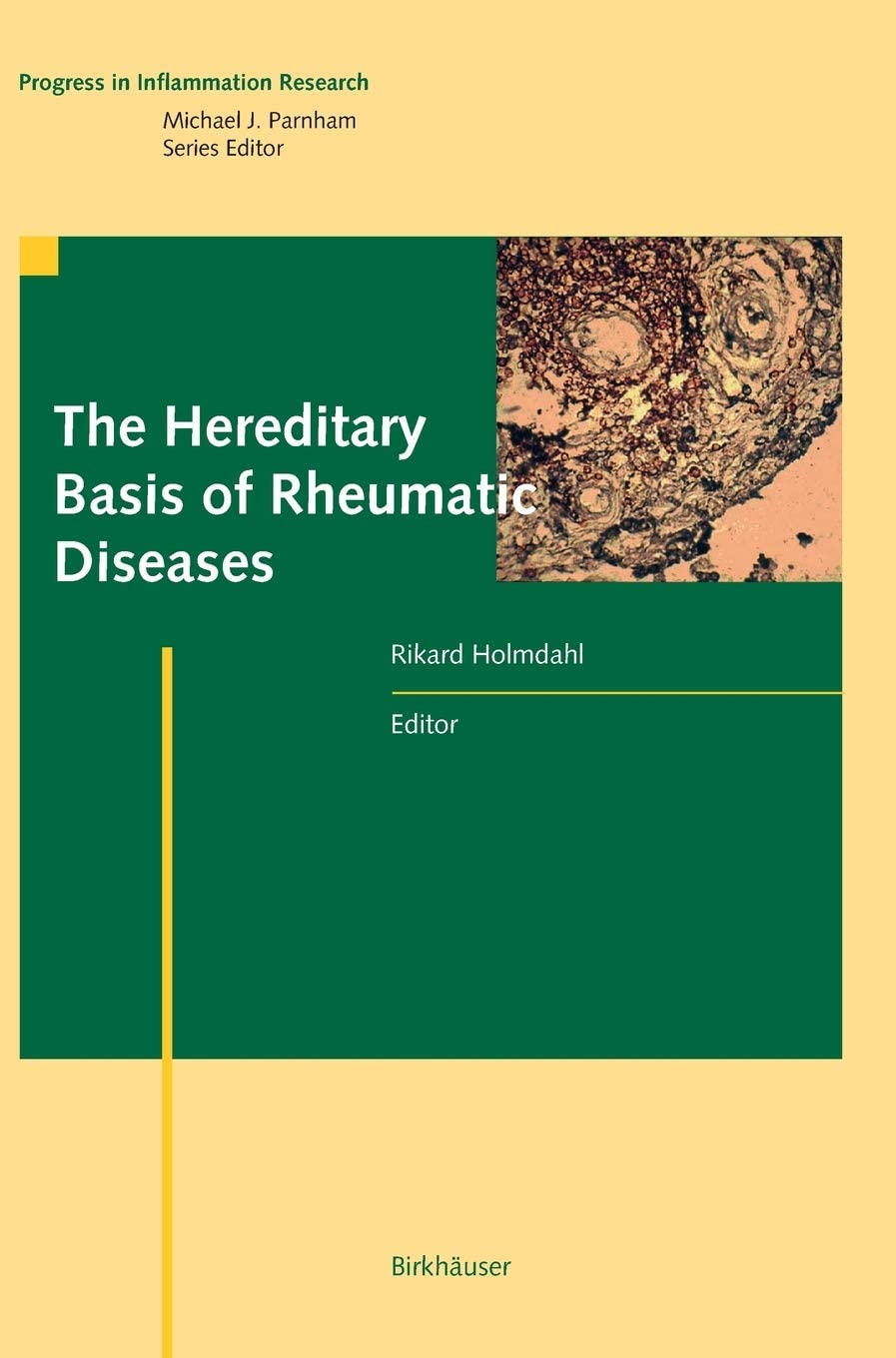 The Hereditary Basis of Rheumatic Diseases