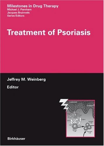 Treatment of psoriasis