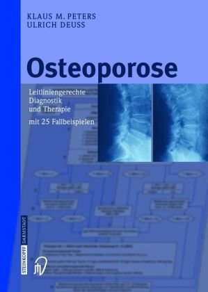 Osteoporose