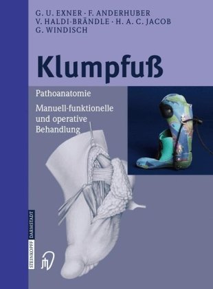 Klumpfuß