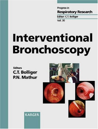 Interventional Bronchoscopy (Progress in Respiratory Research, Vol. 30)