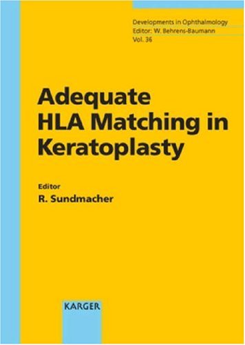 Adequate HLA Matching in Keratoplasty