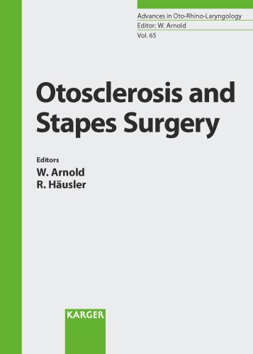 Otosclerosis and Stapes Surgery