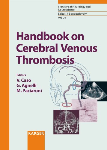 Handbook on cerebral venous thrombosis