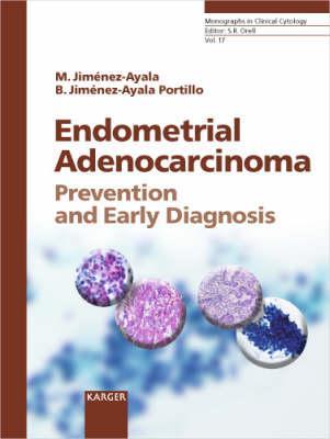 Endometrial Adenocarcinoma