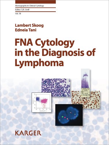 Fna Cytology in the Diagnosis of Lymphoma